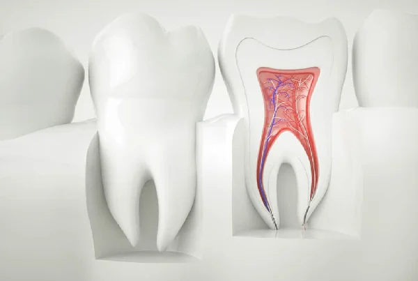 Endodontic Retreatment